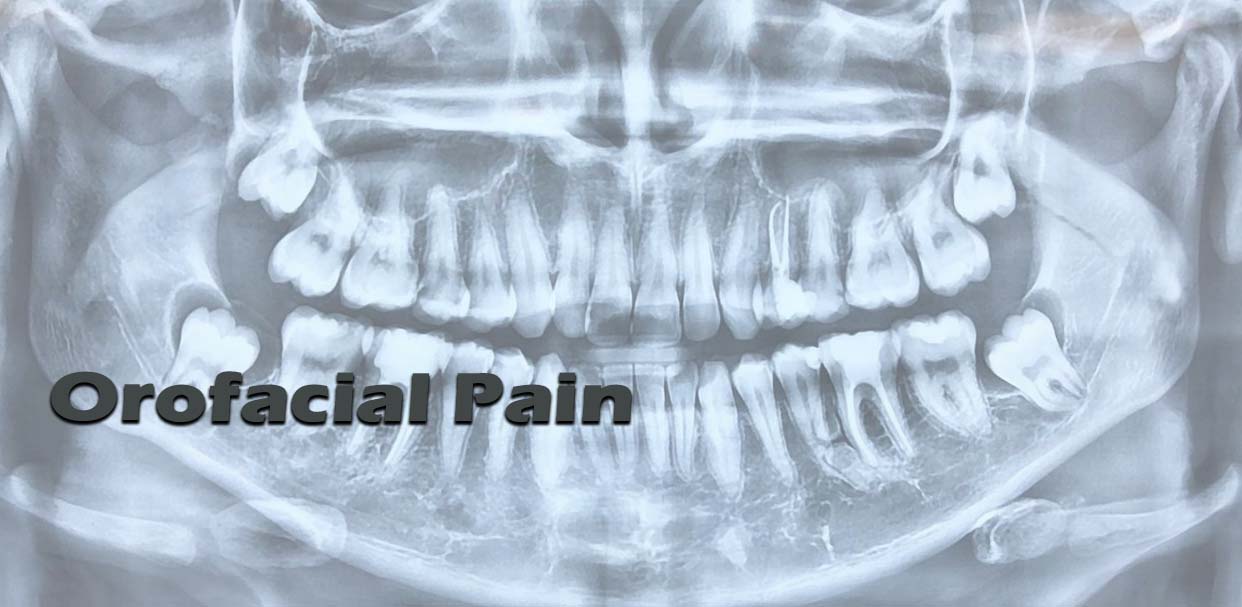 Orofacial Pain